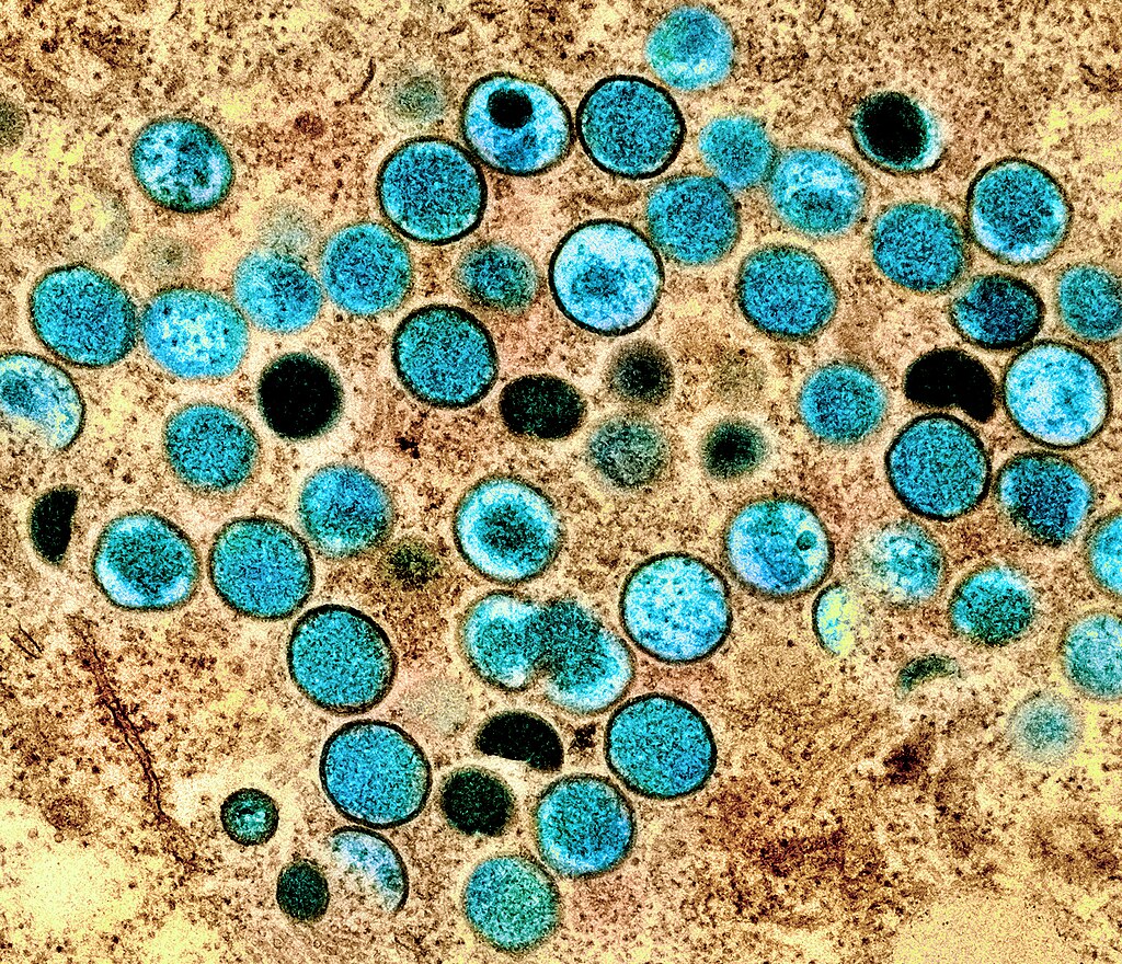 Monkeypox virus